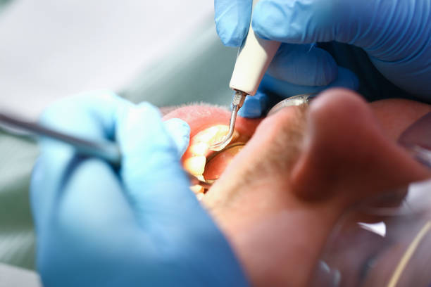 Best Emergency Root Canal Treatment in Hughes Springs, TX